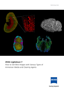 Image d’aperçu de ZEISS Lightsheet 7