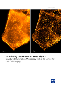 Image d’aperçu de Introducing Lattice SIM for ZEISS Elyra 7